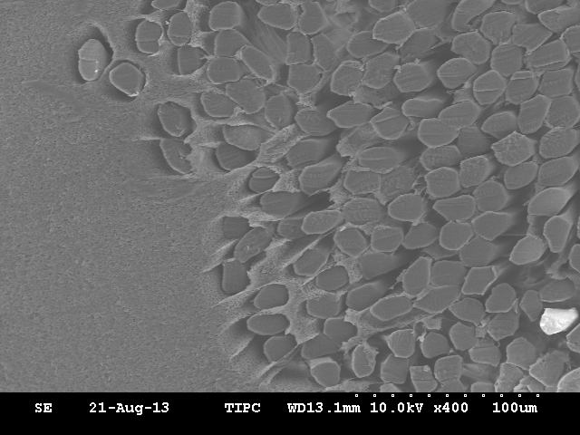 SEM microstructure of cross section of hollow fiber membrane